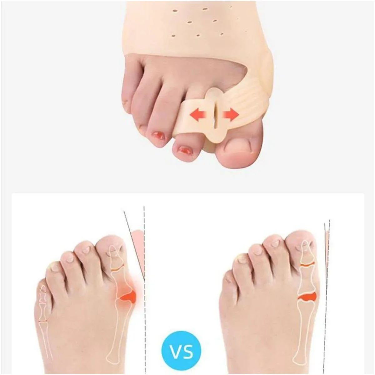 Ortho Toe Corrector